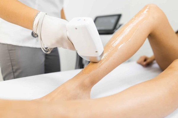 Dire adieu aux poils indésirables grâce à une épilation laser de qualité